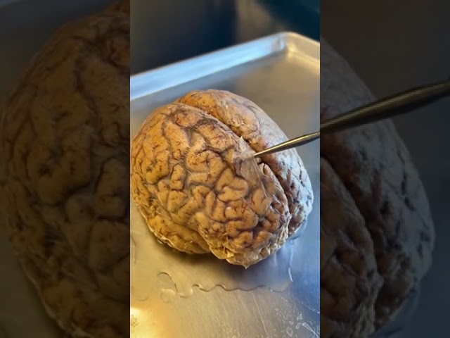 caja osea que contiene el encefalo