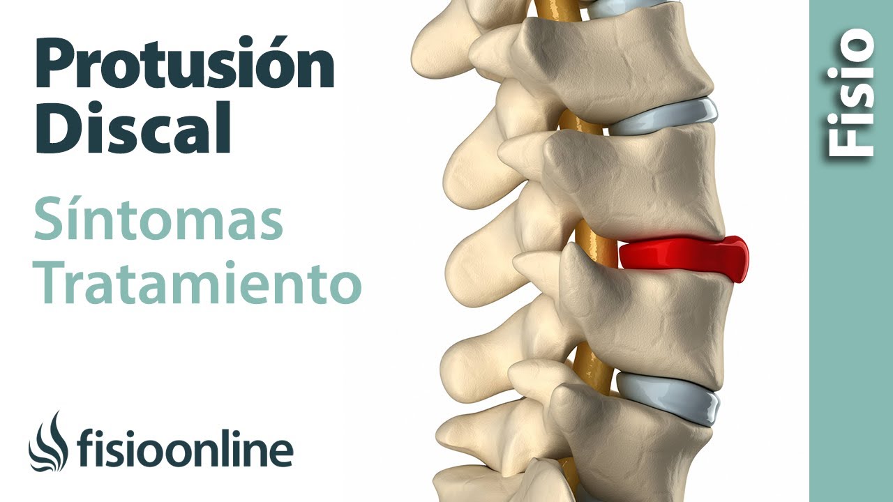 como curar protusion discal l5 s1