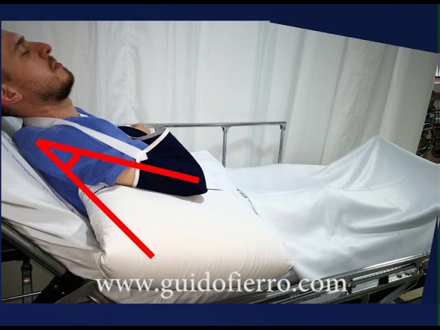 como dormir despues de una artroscopia de hombro