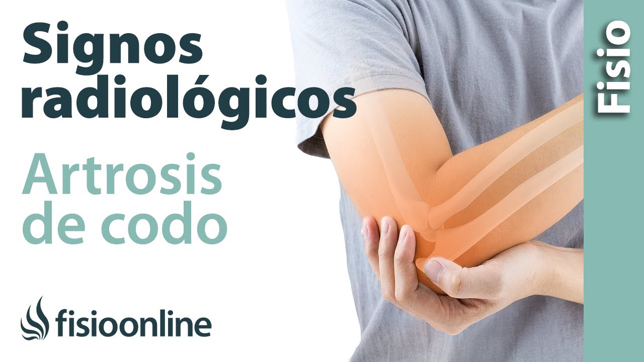 como se cura la artrosis del codo