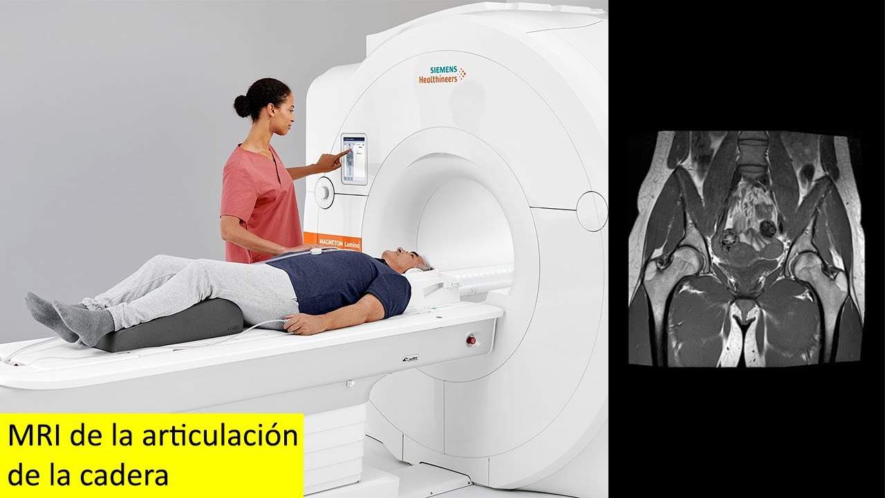 como se hace una resonancia de cadera
