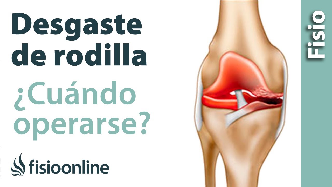 cuando es necesario una protesis de rodilla