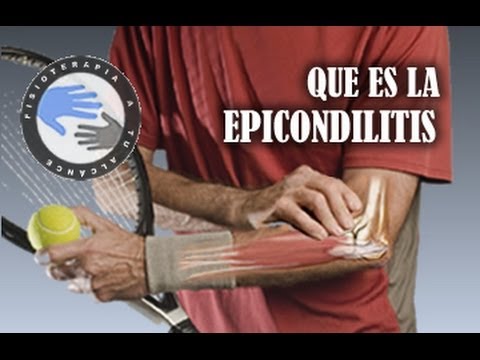 cuando se decide operar la epicondilitis del codo