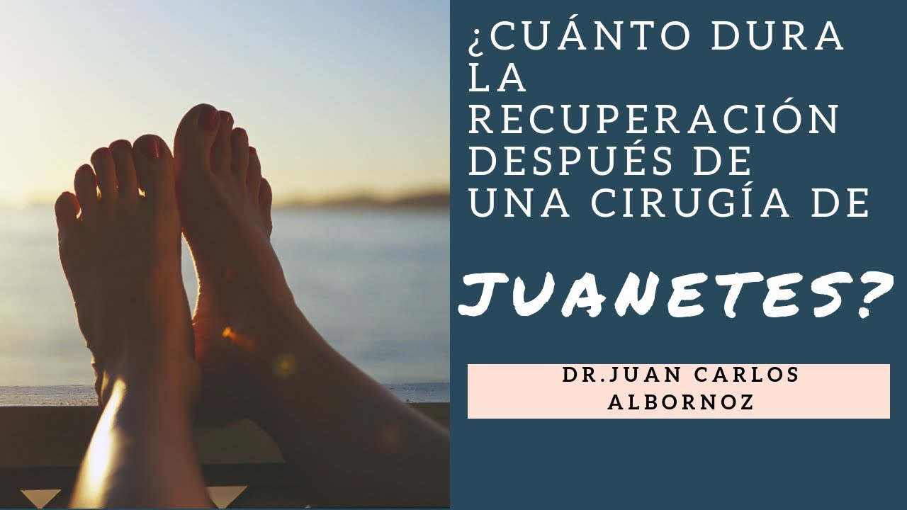 cuanto dura una operacion de juanete