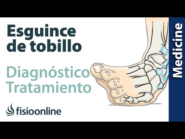diagnostico de un esguince de tobillo
