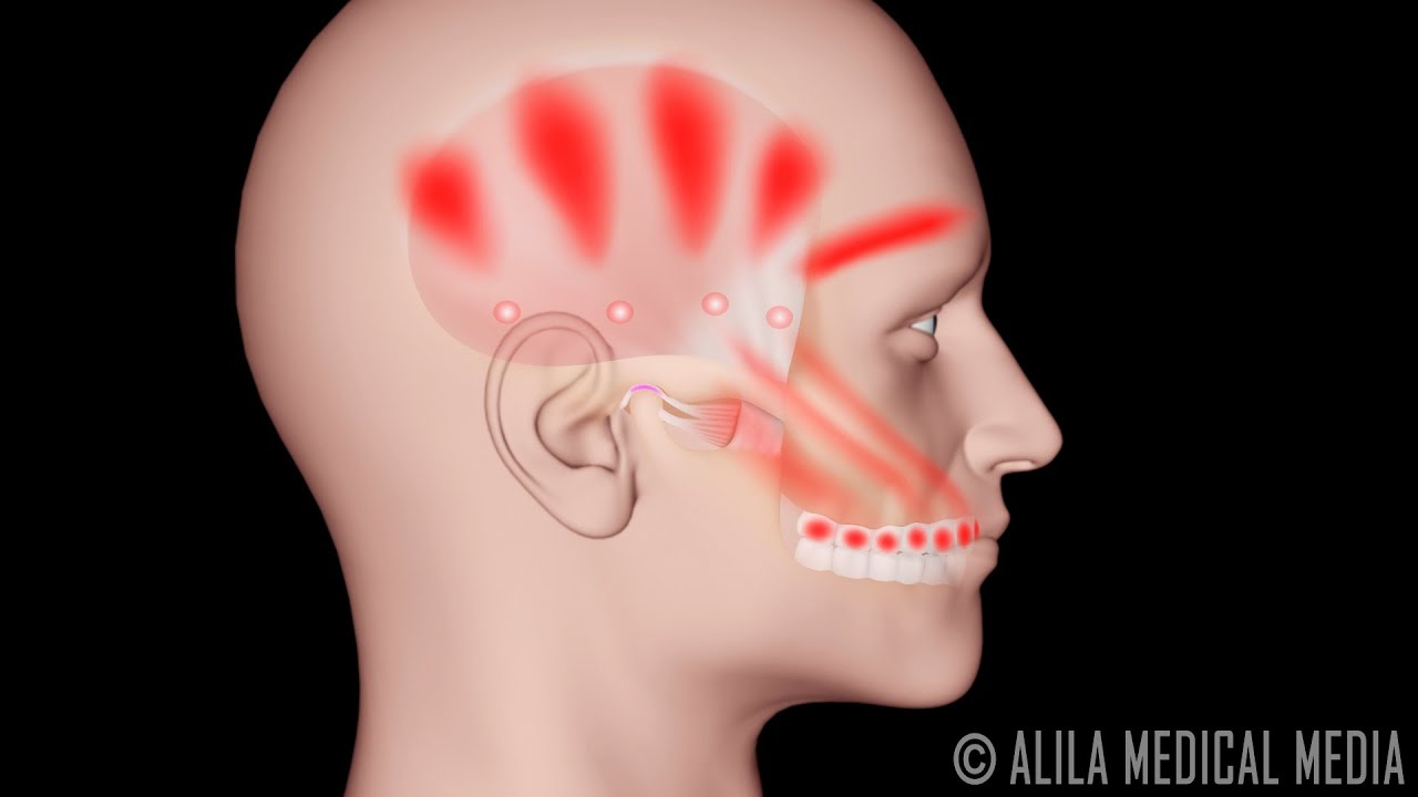 dolor de mandibula oido y garganta