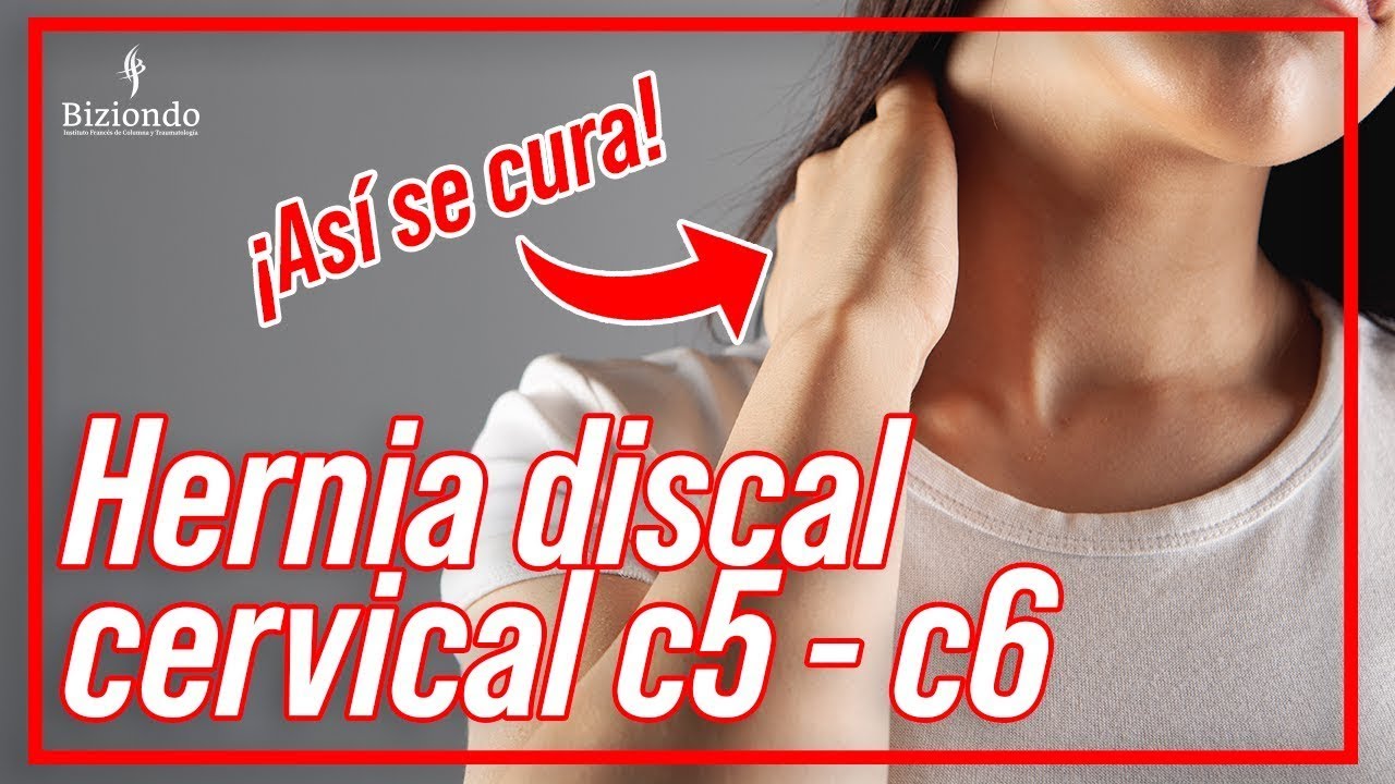 donde esta la c5 y c6