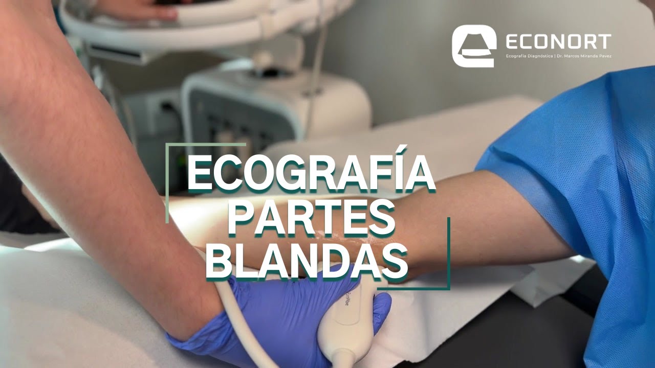 ecografia de partes blandas para que sirve