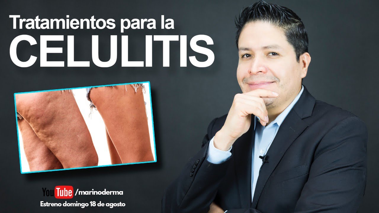el electroestimulador sirve para la celulitis