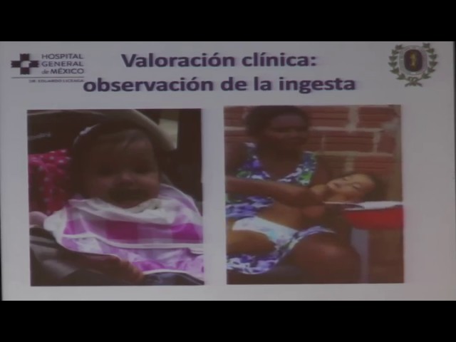 evaluación y tratamiento de las alteraciones de la deglución