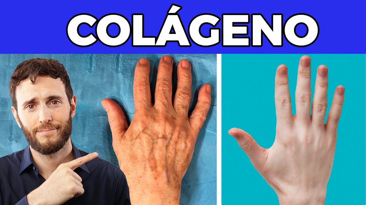 falta de colágeno en la piel