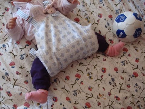 fisioterapia para displasia de cadera en bebes