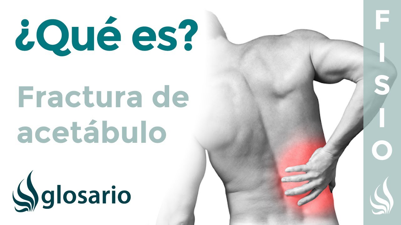 fractura de acetabulo tratamiento sin cirugia