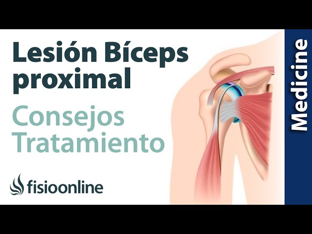 inflamación del tendón largo del bíceps