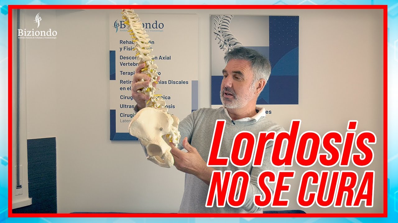 inversión de la lordosis cervical fisiológica