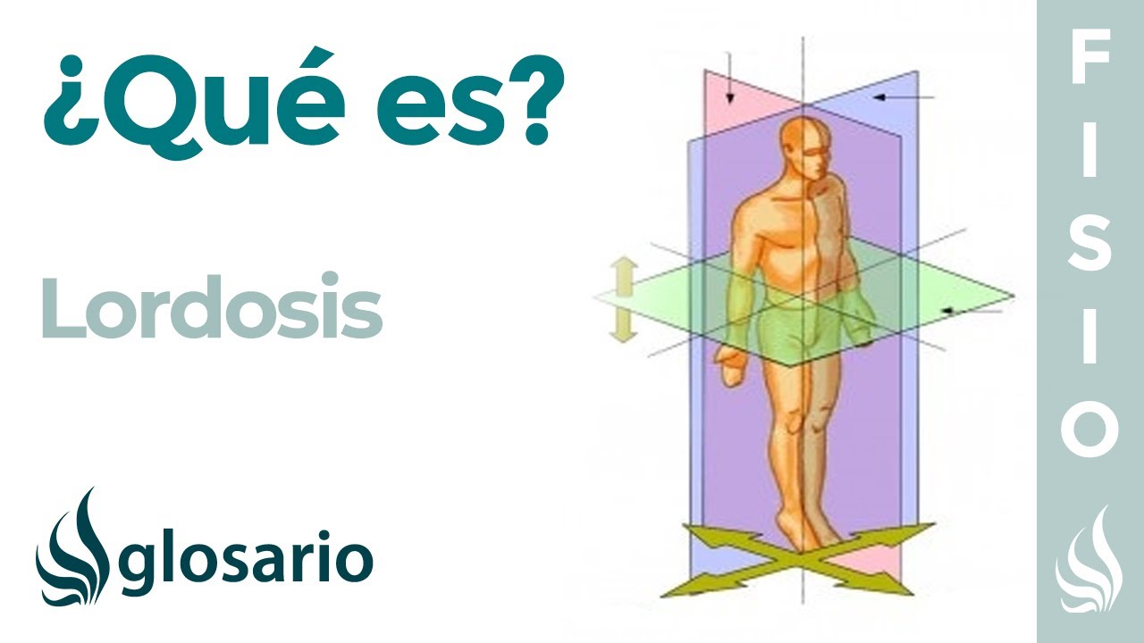 lordosis fisiologica de la columna cervical