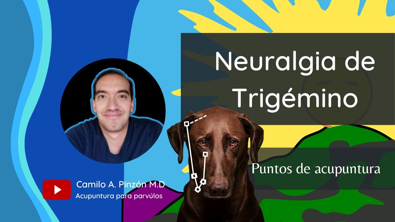 neuralgia del trigemino tratamiento con acupuntura