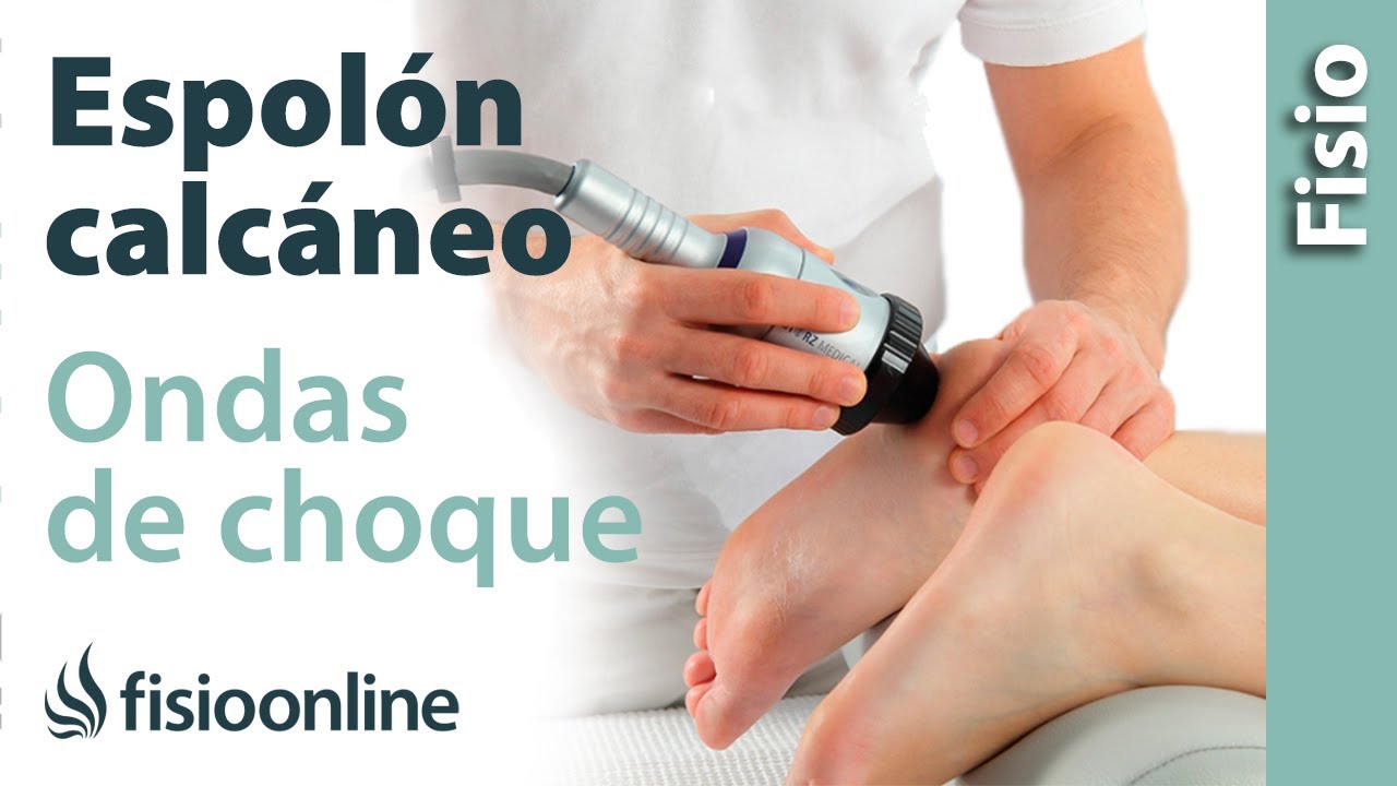 ondas de choque para espolon calcaneo