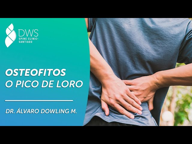 pico de loro en la columna