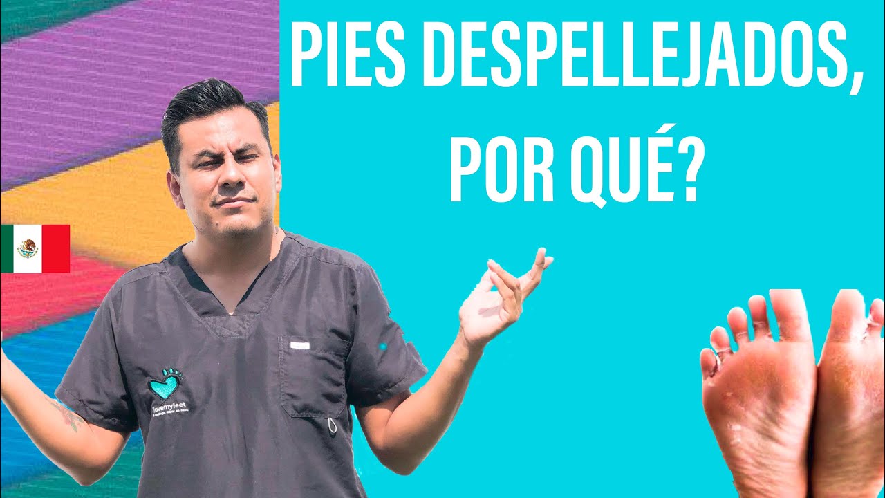 porque se pelan los pies de los niños