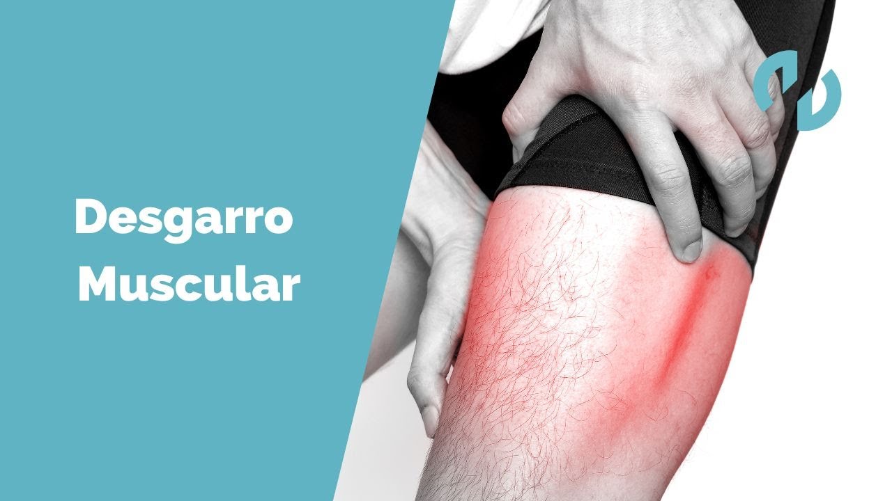 porque se producen los desgarros musculares