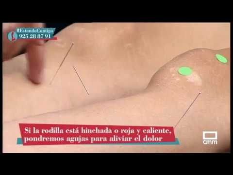 puntos de acupuntura para dolor de rodilla