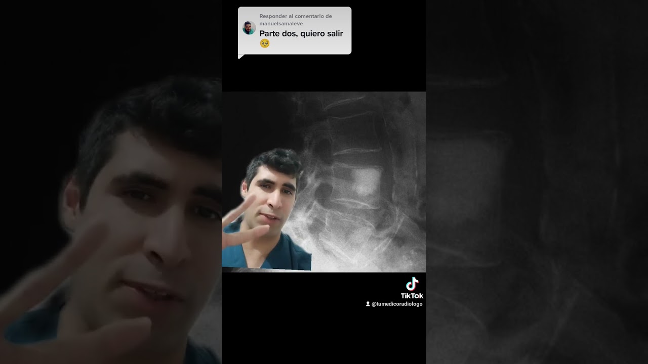 que se ve en una radiografia de espalda