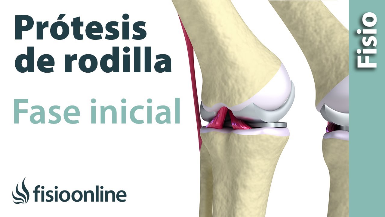 rehabilitacion despues de cirugia de rodilla protesis