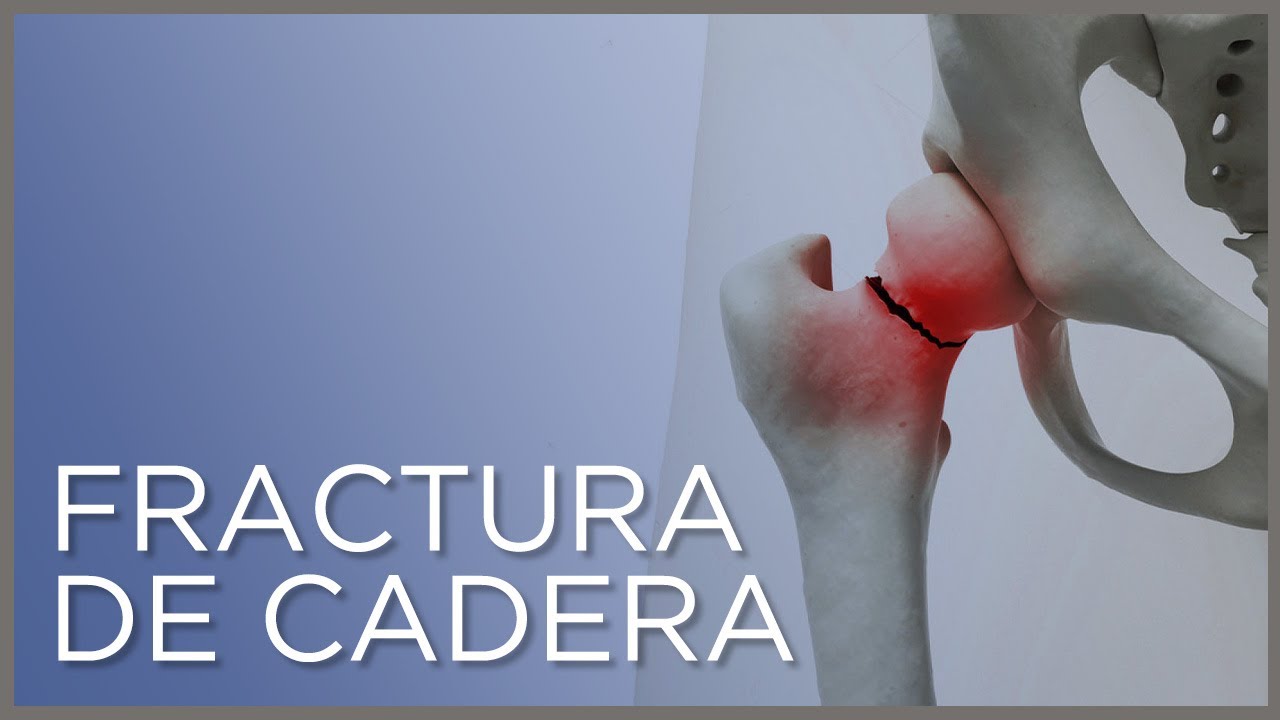 rotura de cadera en personas mayores recuperacion