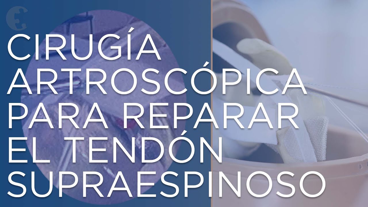 rotura de espesor parcial del tendón supraespinoso