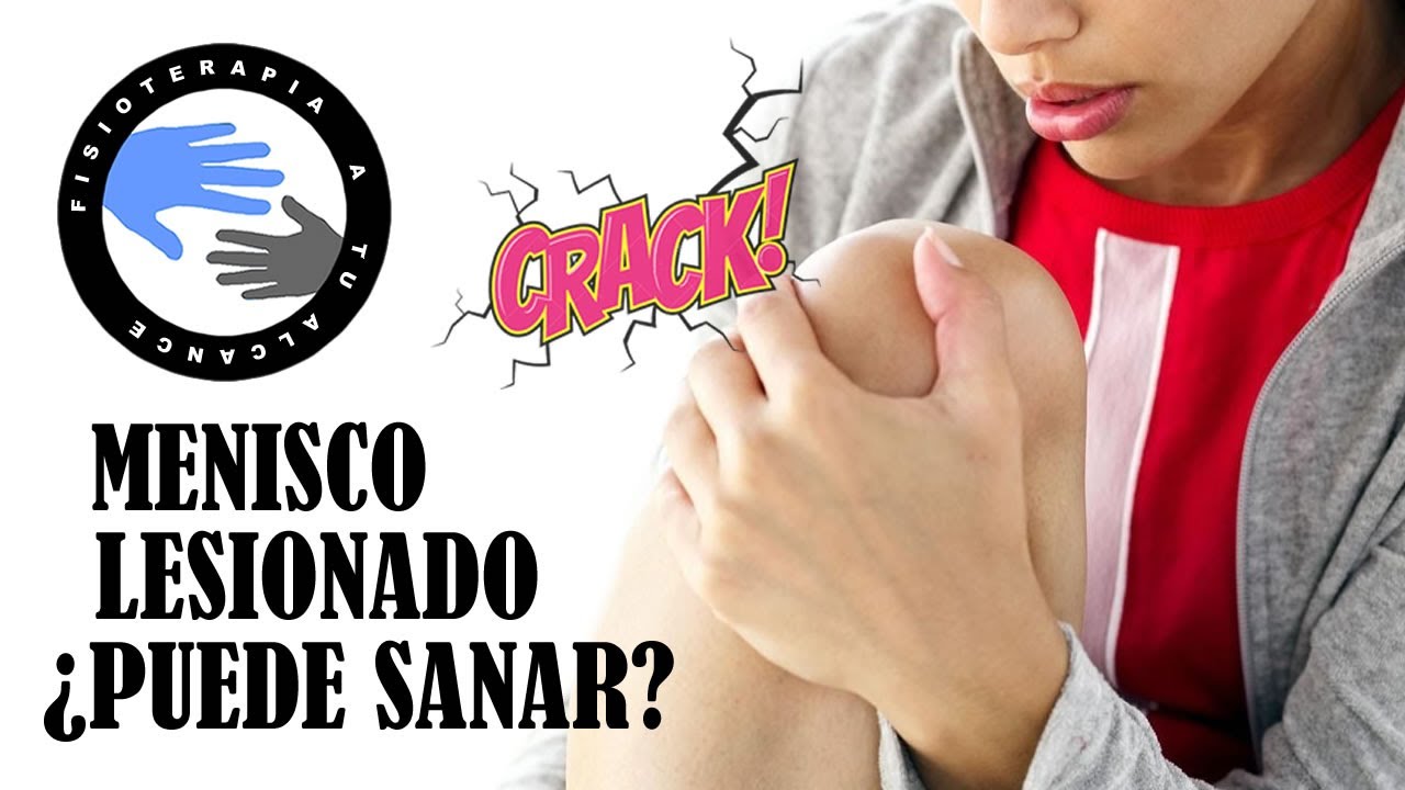 se puede curar un menisco roto sin operacion