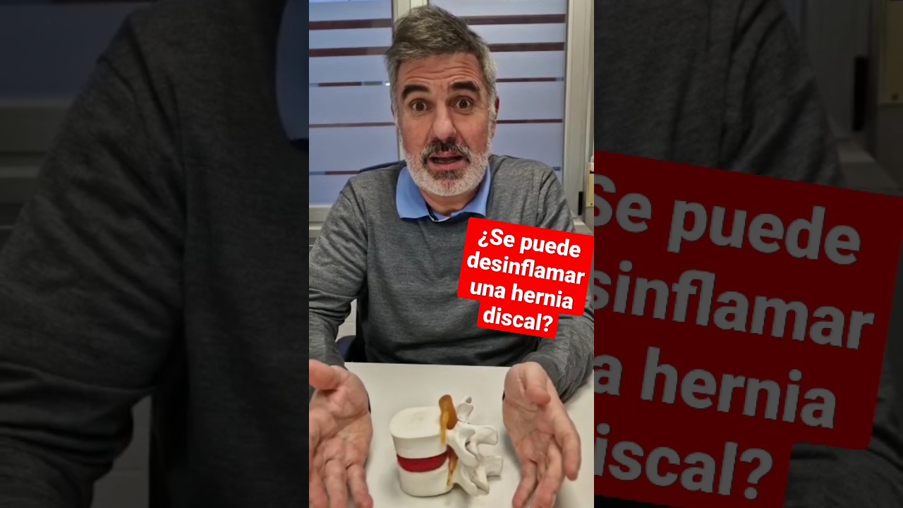 se puede palpar una hernia discal