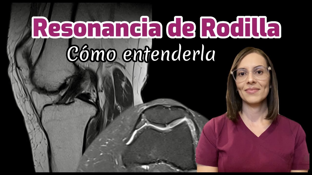 se puede ver una tendinitis con una resonancia