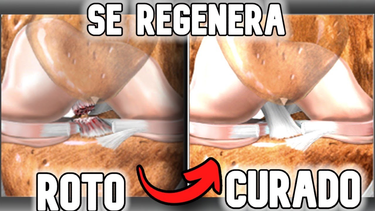 se regenera el ligamento cruzado anterior