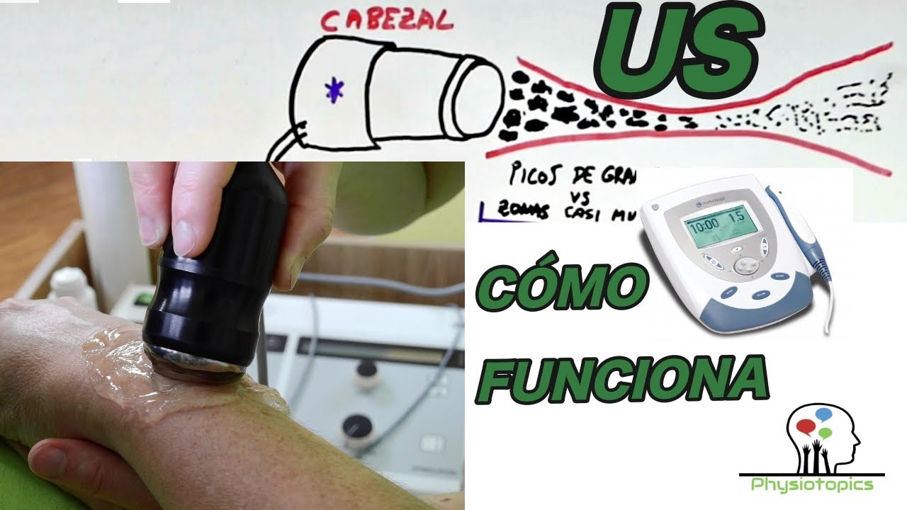 tecnicas de aplicacion de ultrasonido terapeutico