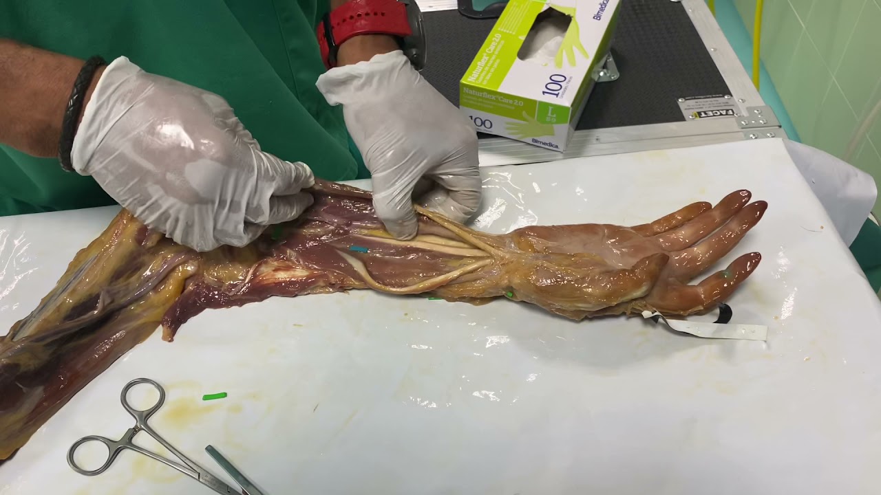 tendon flexor superficial de los dedos