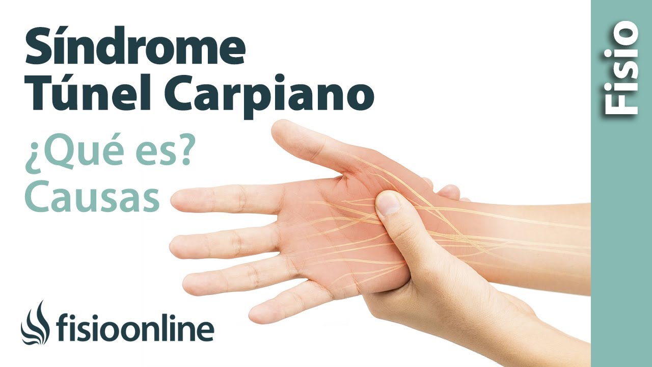 trabajos que producen sindrome del tunel carpiano