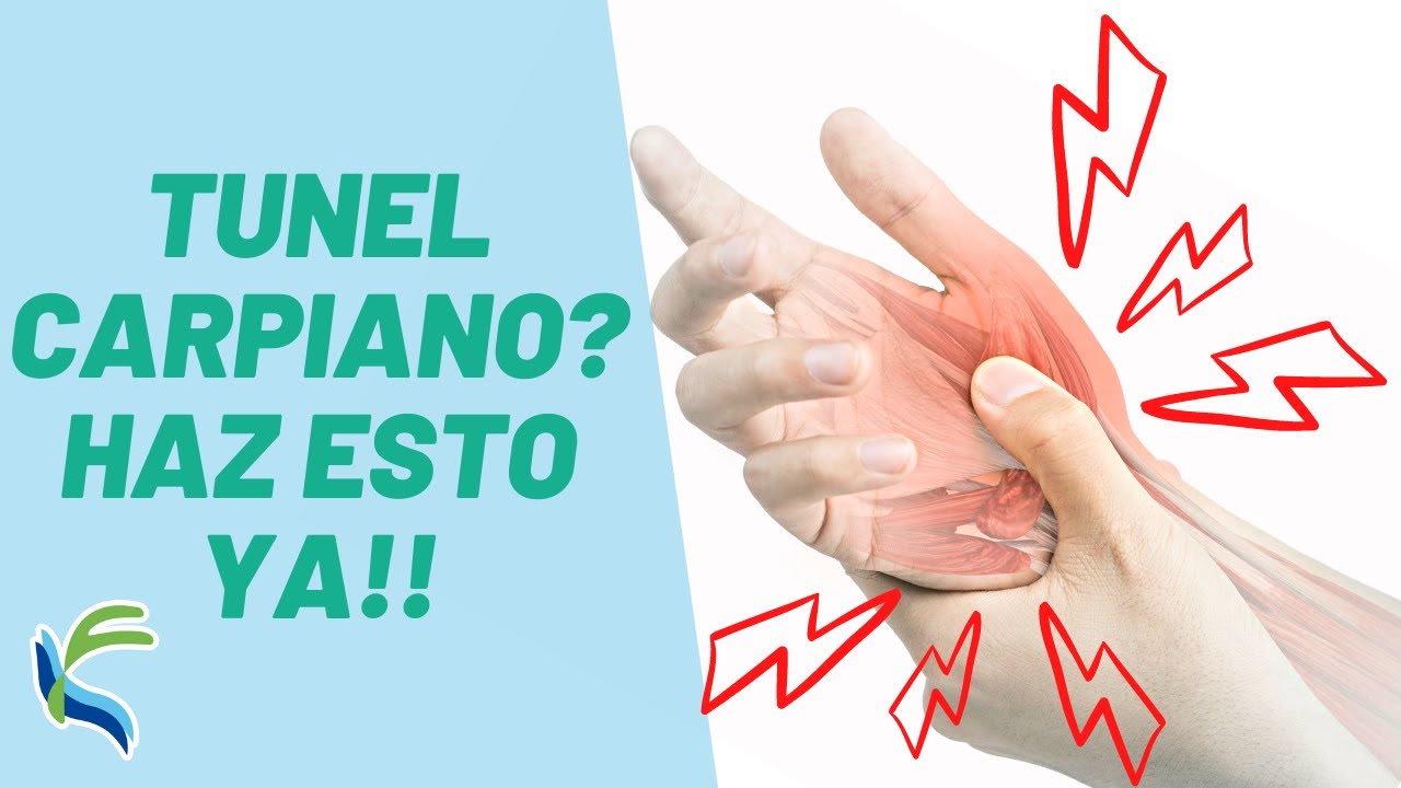 tratamiento fisioterapeutico sindrome del tunel carpiano
