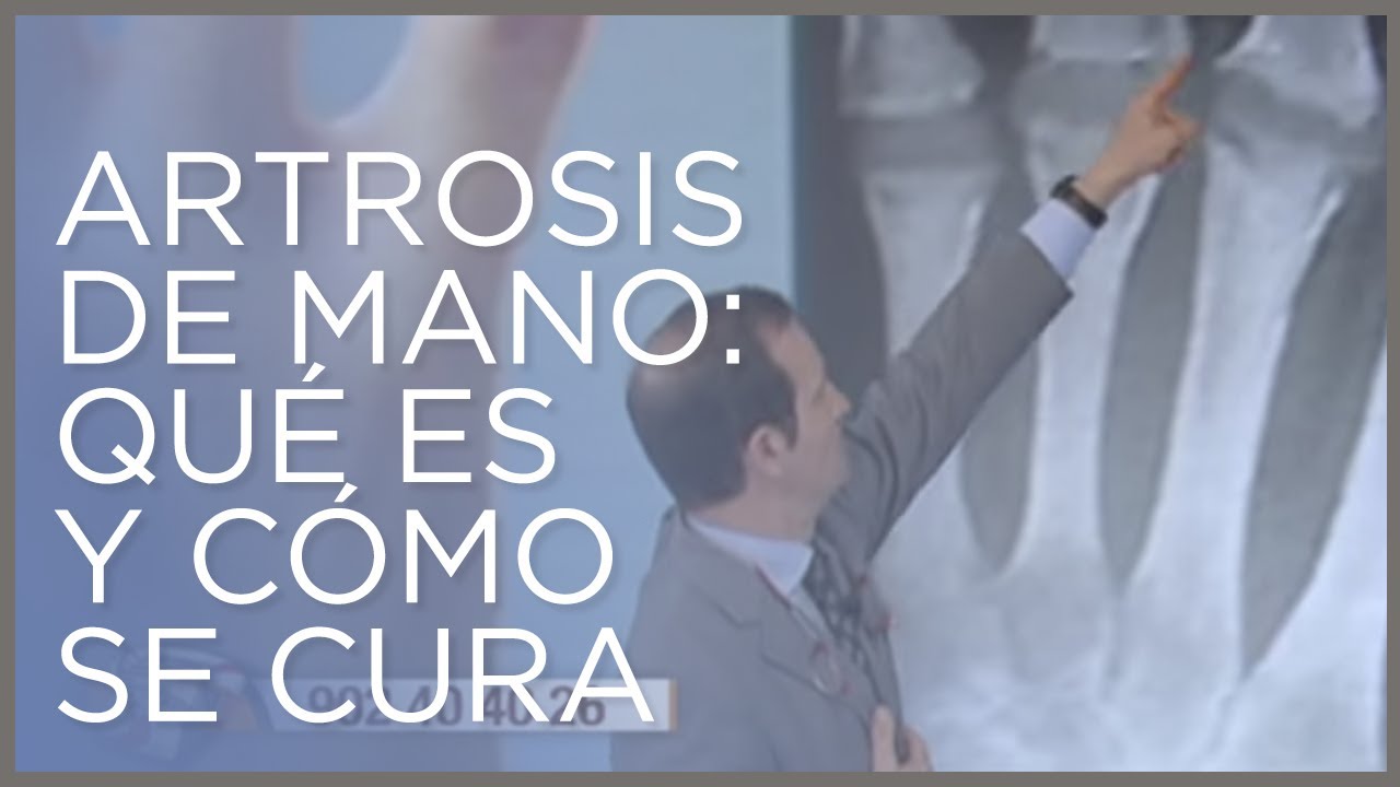 tratamiento para la artrosis en las manos