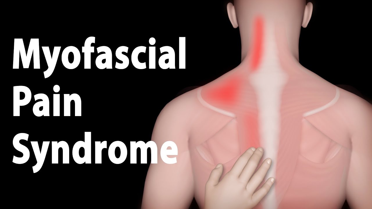travell and simons myofascial pain and dysfunction