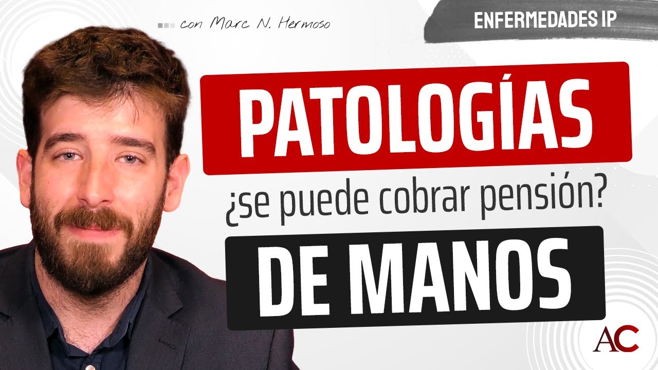 baja por artrosis en las manos