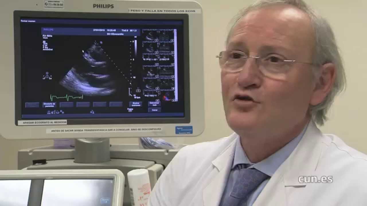 beneficios de la actividad fisica en enfermedades cardiovasculares