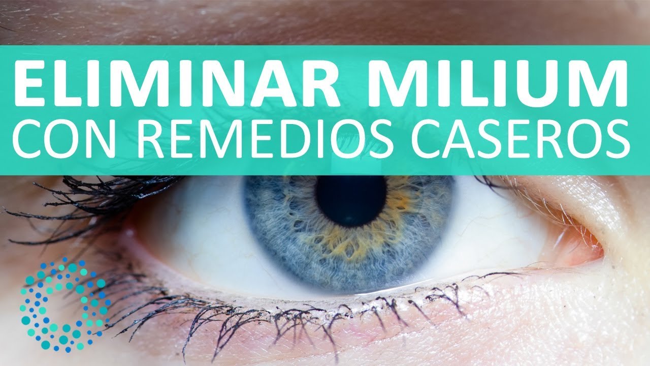 bolitas de grasa en los ojos remedios caseros