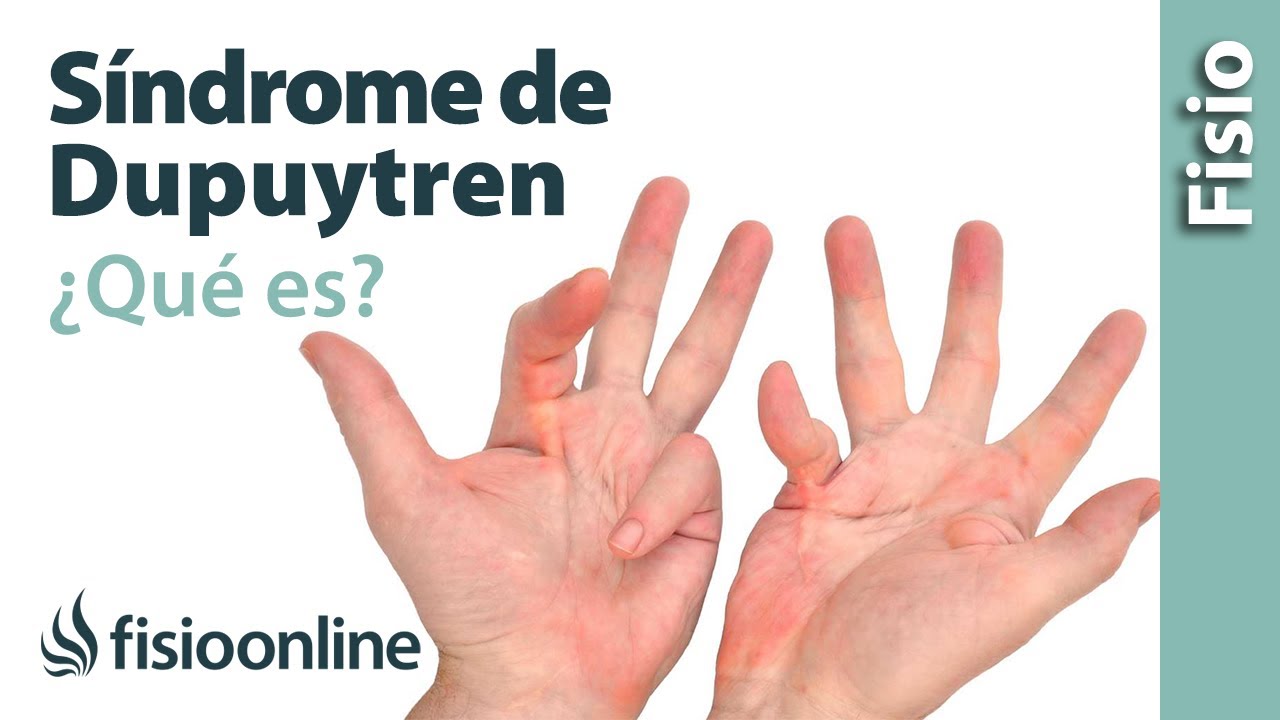 bulto en la palma de la mano con dolor