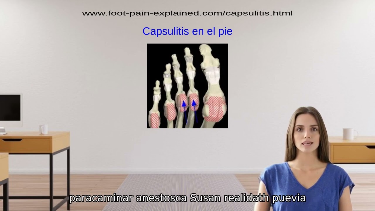 capsulitis del segundo dedo del pie