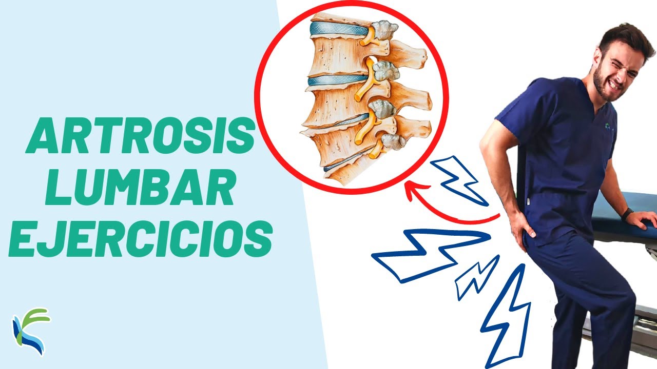 como aliviar el dolor de artrosis lumbar