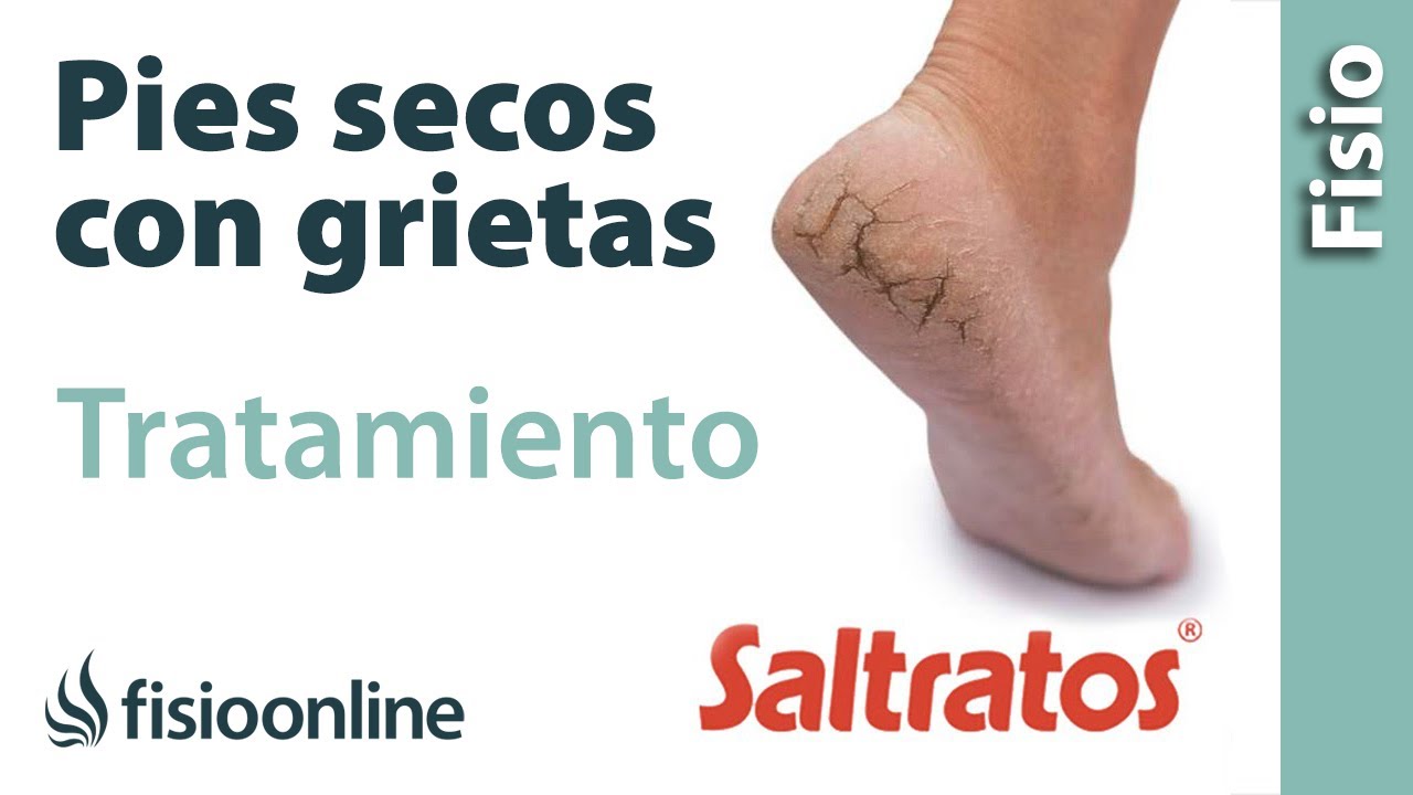 como curar grietas en los dedos de los pies