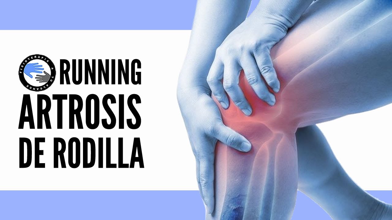 con artrosis de rodilla se puede correr