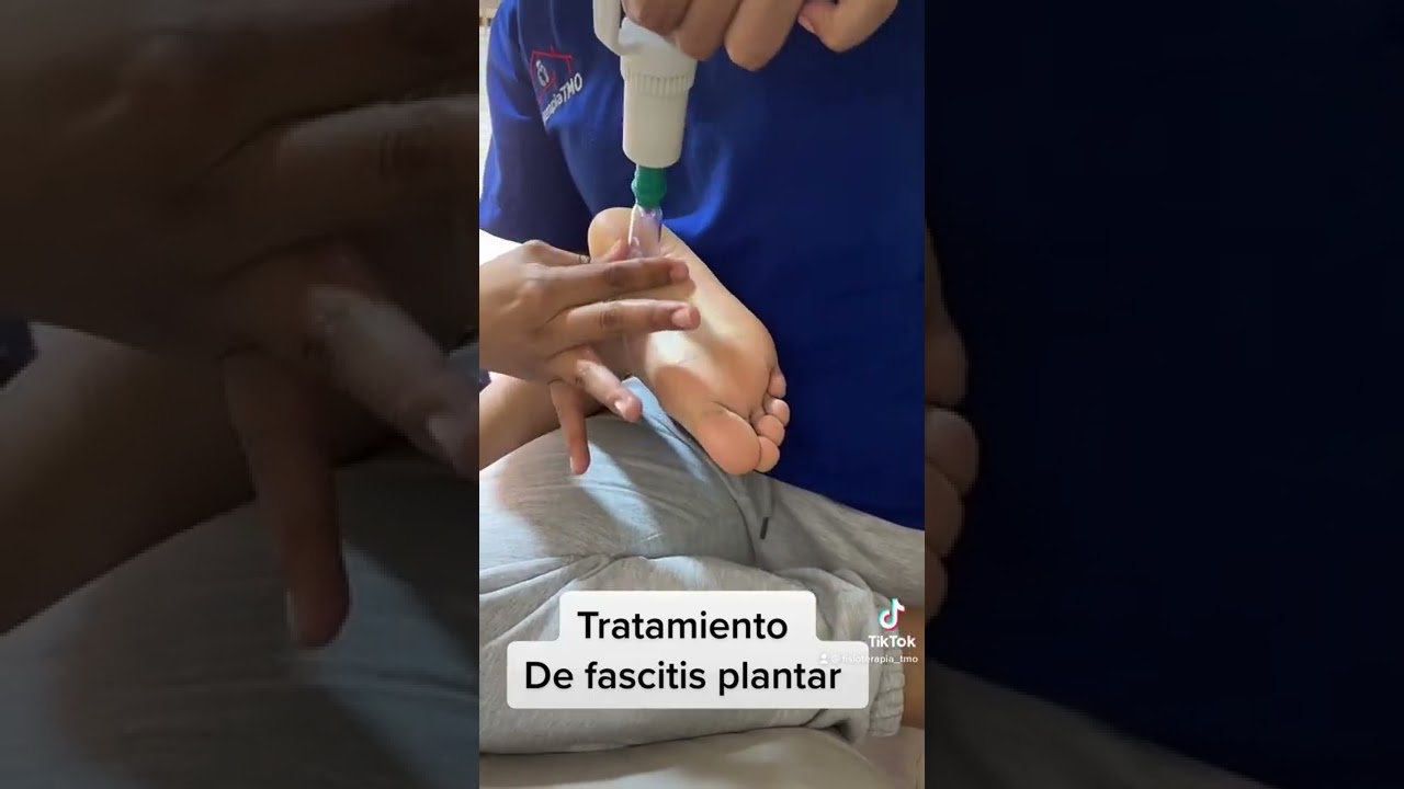 crema antiinflamatoria para la fascitis plantar