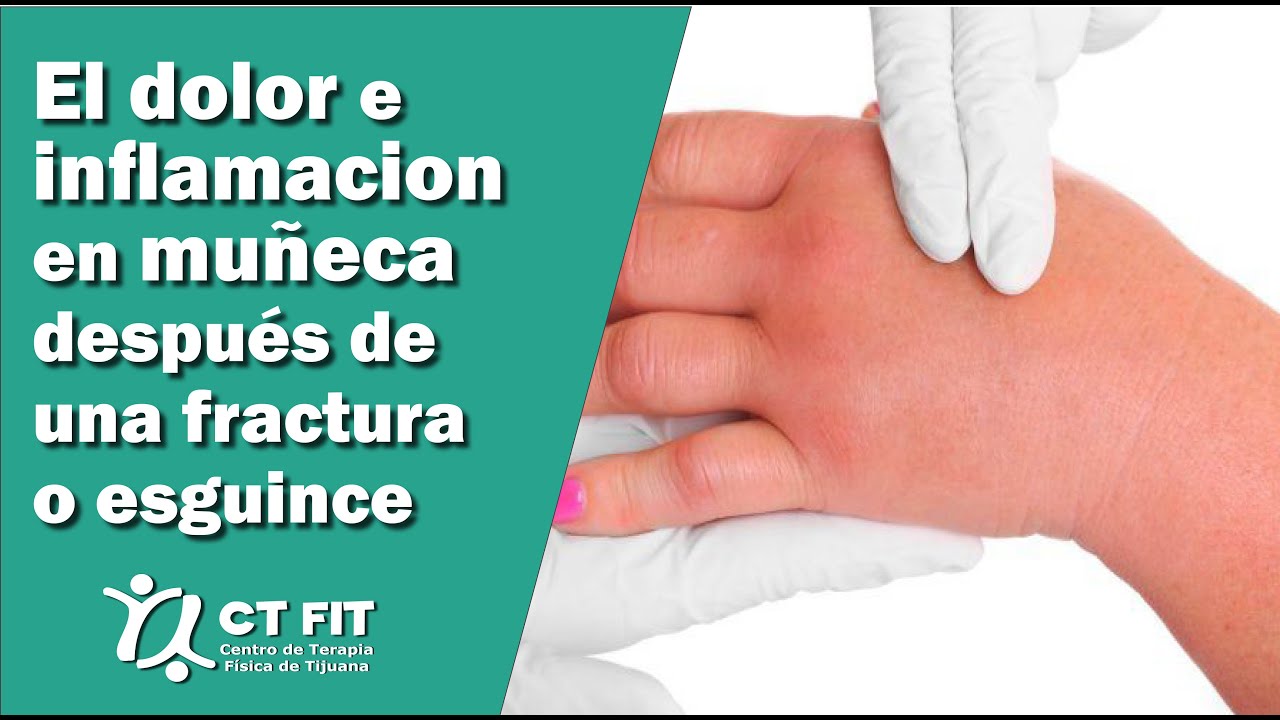 cuanto dura la inflamacion despues de quitar el yeso